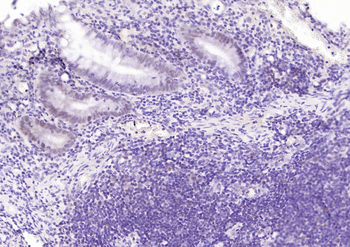 MLH1 Mouse Monoclonal Antibody