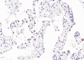 TTF1/NKX2-1 Mouse Monoclonal Antibody