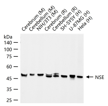NSE Recombinant Rabbit Monoclonal Antibody