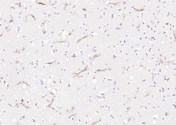 Nestin Mouse Monoclonal Antibody