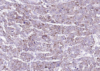 ACOT13 Rabbit Polyclonal Antibody
