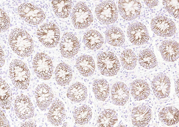 ATP1A1 Rabbit Polyclonal Antibody