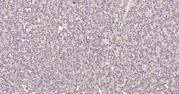LAMP1 Rabbit Polyclonal Antibody