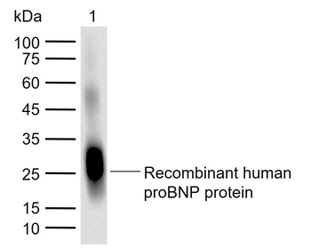 ProBNP Mouse Monoclonal Antibody
