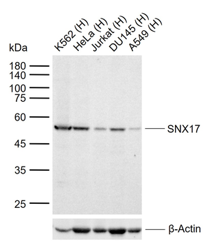 SNX17 Rabbit Polyclonal Antibody