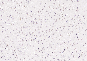 Phospho-PIN1 (Ser71) Rabbit Polyclonal Antibody