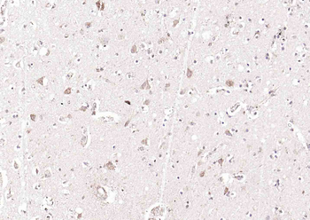 GGNBP2 Rabbit Polyclonal Antibody
