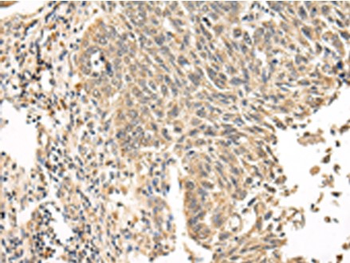 VPS53 Rabbit Polyclonal Antibody