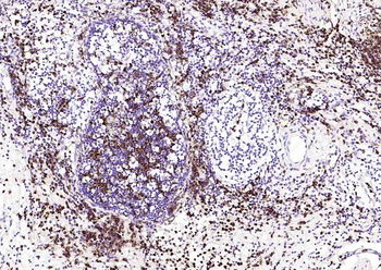 CEACAM5 Mouse Monoclonal Antibody