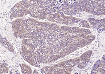 NME1/NM23A Rabbit Polyclonal Antibody