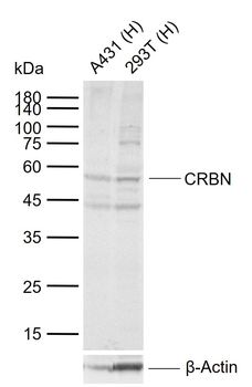 CRBN Rabbit Polyclonal Antibody