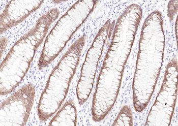 Villin Mouse Monoclonal Antibody