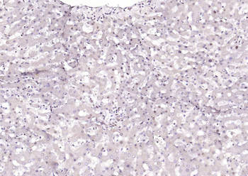 HNF1A Rabbit Polyclonal Antibody