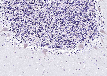 PDE1B Rabbit Polyclonal Antibody
