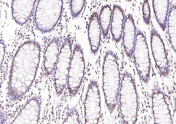 BRD2 Rabbit Polyclonal Antibody