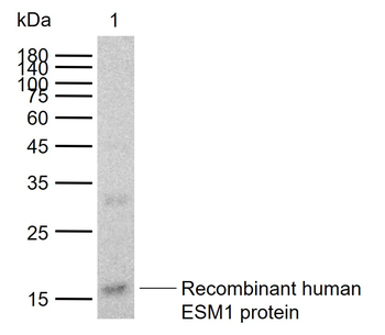 ESM1 Mouse Monoclonal Antibody