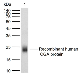 Human CGA Mouse Monoclonal Antibody