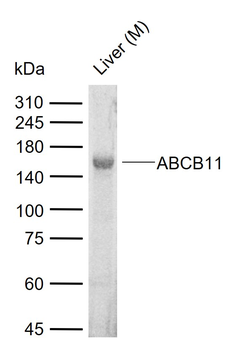 ABCB11 Rabbit Polyclonal Antibody