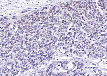 Histone H3 (tri methyl K9) Rabbit Polyclonal Antibody