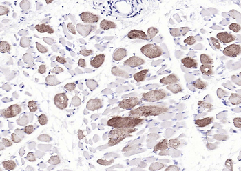 Osteocalcin Mouse Monoclonal Antibody