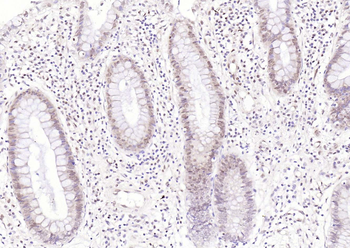 Phospho-STAT3 (Ser727) Rabbit Polyclonal Antibody