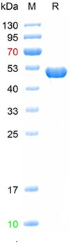 Recombinant human NF-H protein, N-His
