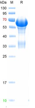 Recombinant mouse MERTK protein, His