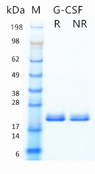Recombinant human G-CSF protein (Active, HEK293)
