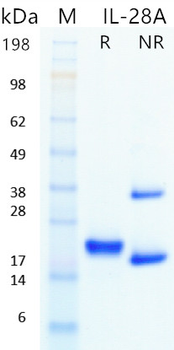 Recombinant human IL-28A protein (Active, HEK293)