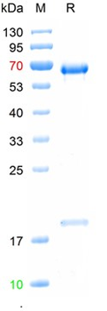 Recombinant human PCSK9 protein, C-His (HEK293)