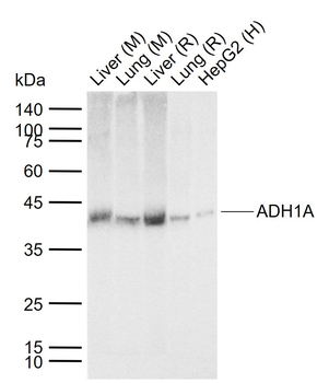 ADH1A Rabbit Polyclonal Antibody