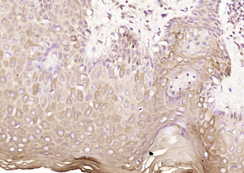 Ataxin 3 Rabbit Polyclonal Antibody