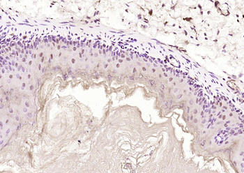 Ataxin 3 Rabbit Polyclonal Antibody