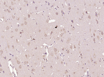 Big dynorphin Rabbit Polyclonal Antibody