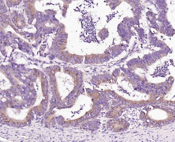 Beta neoendorphin Rabbit Polyclonal Antibody