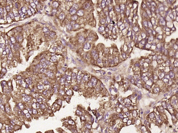 C19orf57 Rabbit Polyclonal Antibody