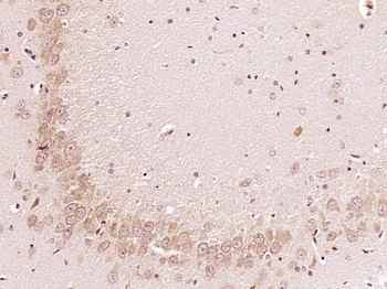 C19orf61 Rabbit Polyclonal Antibody
