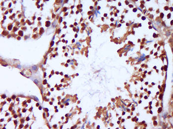 C19orf67 Rabbit Polyclonal Antibody