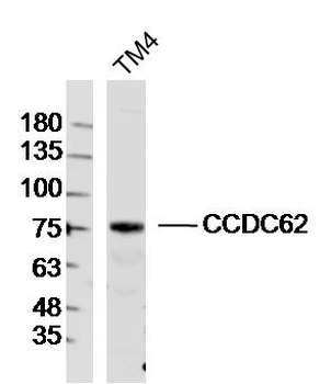 CCDC62 Rabbit Polyclonal Antibody