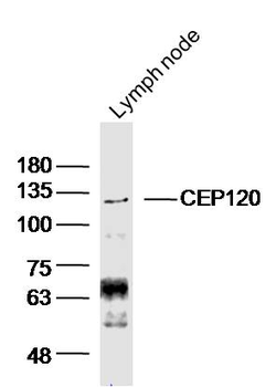 CEP120 Rabbit Polyclonal Antibody