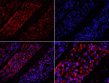 CEP120 Rabbit Polyclonal Antibody