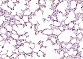 AMCase Rabbit Polyclonal Antibody
