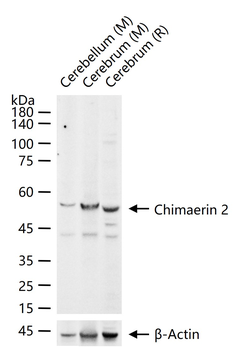 Chimaerin 2 Rabbit Polyclonal Antibody