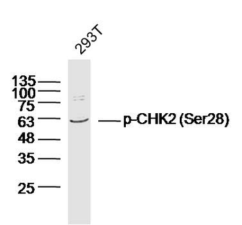 Phospho-CHEK2 (Ser28) Rabbit Polyclonal Antibody