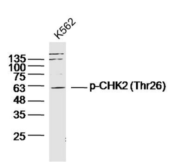 CHK2 (phospho-Thr26) antibody