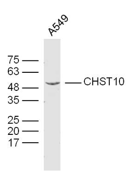 CHST10 Rabbit Polyclonal Antibody