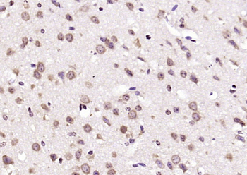 CHST2 Rabbit Polyclonal Antibody