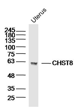 CHST8 Rabbit Polyclonal Antibody