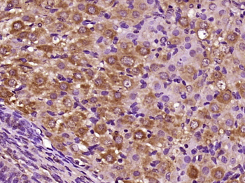 CILP Rabbit Polyclonal Antibody