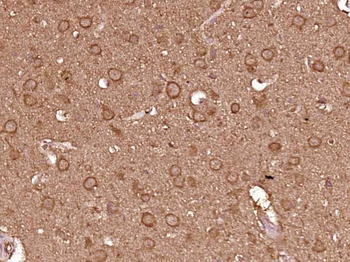 COX18 Rabbit Polyclonal Antibody
